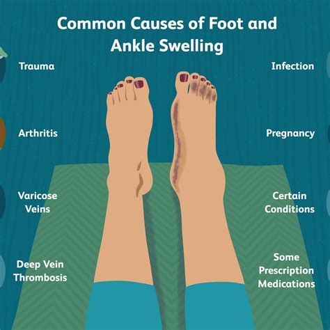 What is the cause of ankle pain图片