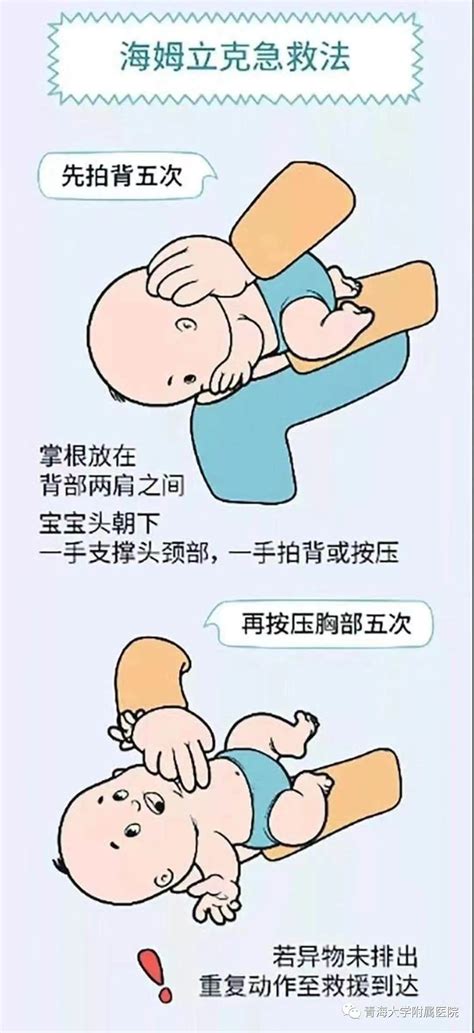 婴儿海姆立克急救法的操作方法