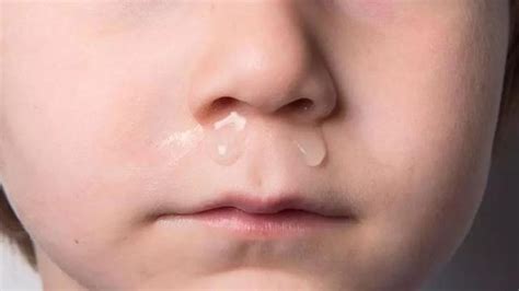 宝宝流鼻涕是什么原因引起的