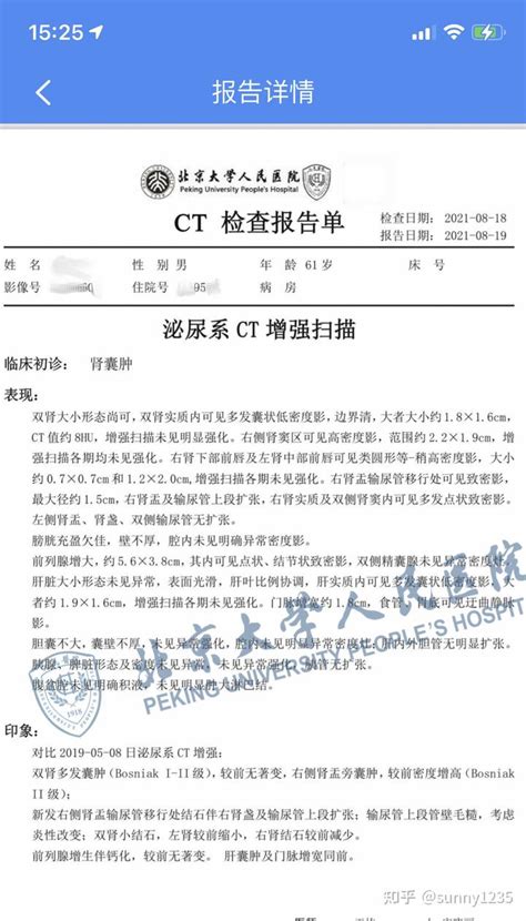 深圳CT报告打印