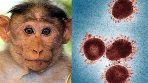 猴痘病毒中国有吗