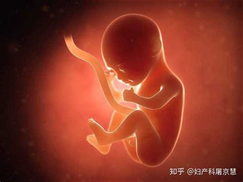 胎儿几周容易脐带绕颈